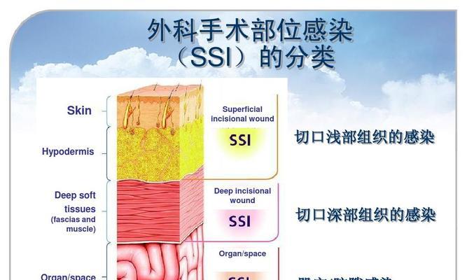 网站手术，从哪些部位动刀？（探秘网站设计与开发中的关键节点）